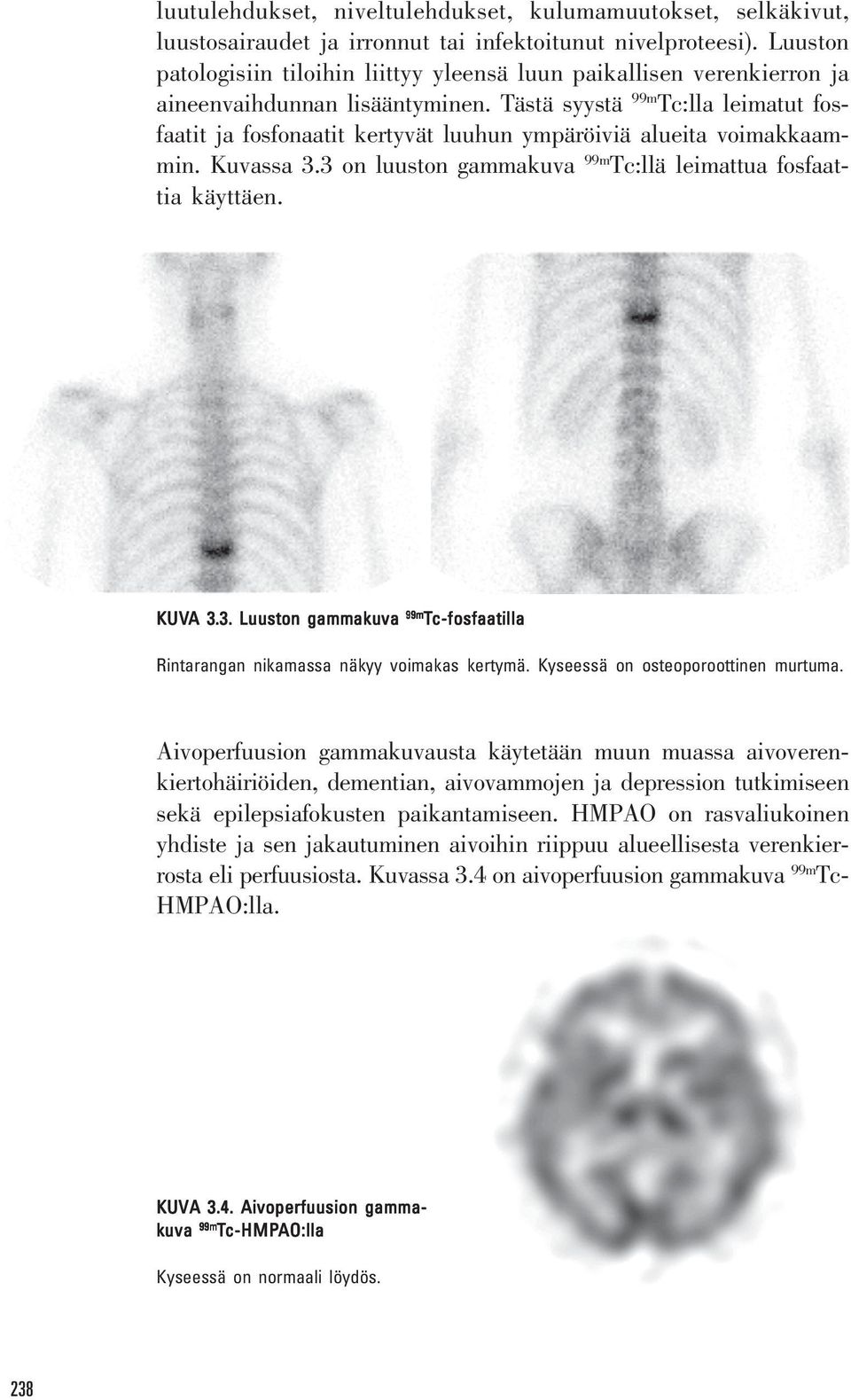 Tästä syystä 99m Tc:lla leimatut fosfaatit ja fosfonaatit kertyvät luuhun ympäröiviä alueita voimakkaammin. Kuvassa 3.