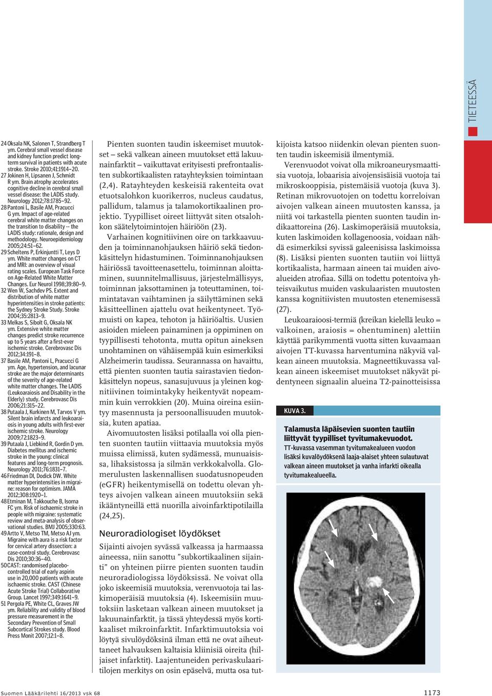 28 Pantoni L, Basile AM, Pracucci G ym. Impact of age-related cerebral white matter changes on the transition to disability -- the LADIS study: rationale, design and methodology.