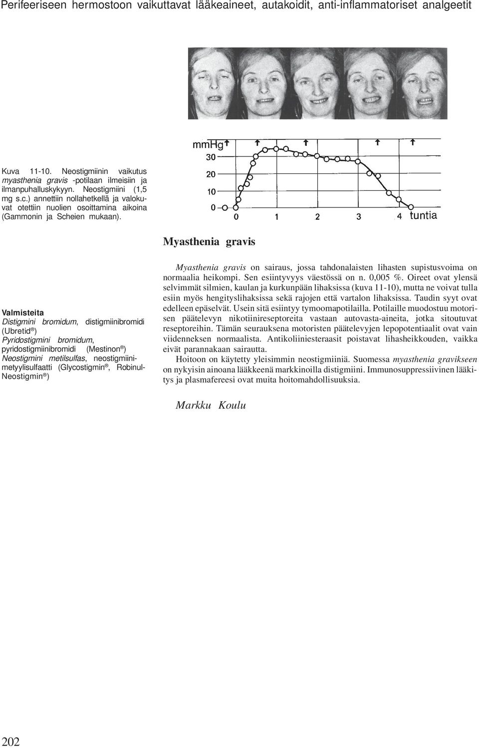 Myasthenia gravis Valmisteita Distigmini bromidum, distigmiinibromidi (Ubretid ) Pyridostigmini bromidum, pyridostigmiinibromidi (Mestinon ) Neostigmini metilsulfas, neostigmiinimetyylisulfaatti