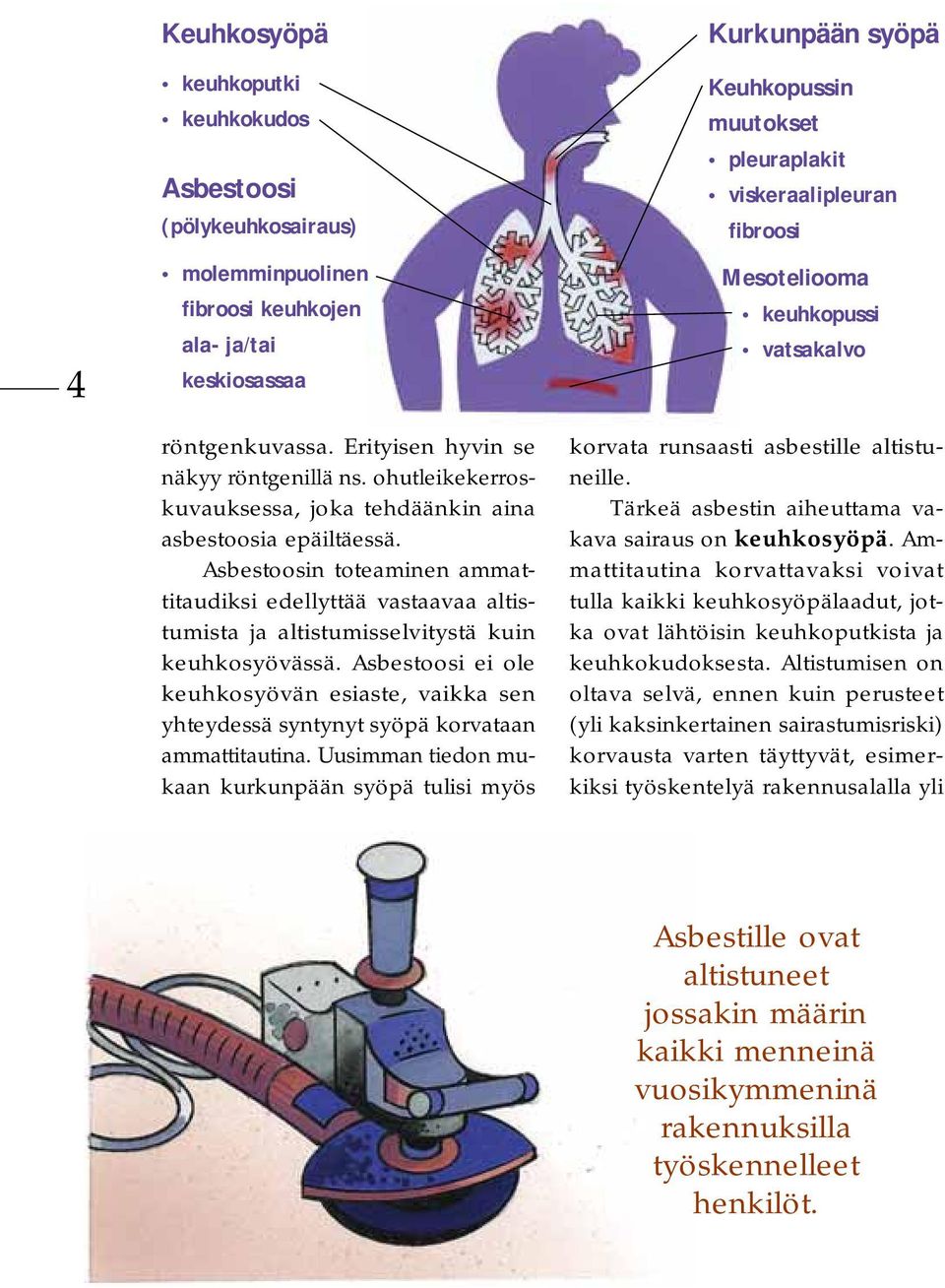 Asbestoosi ei ole keuhkosyövän esiaste, vaikka sen yhteydessä syntynyt syöpä korvataan ammattitautina.