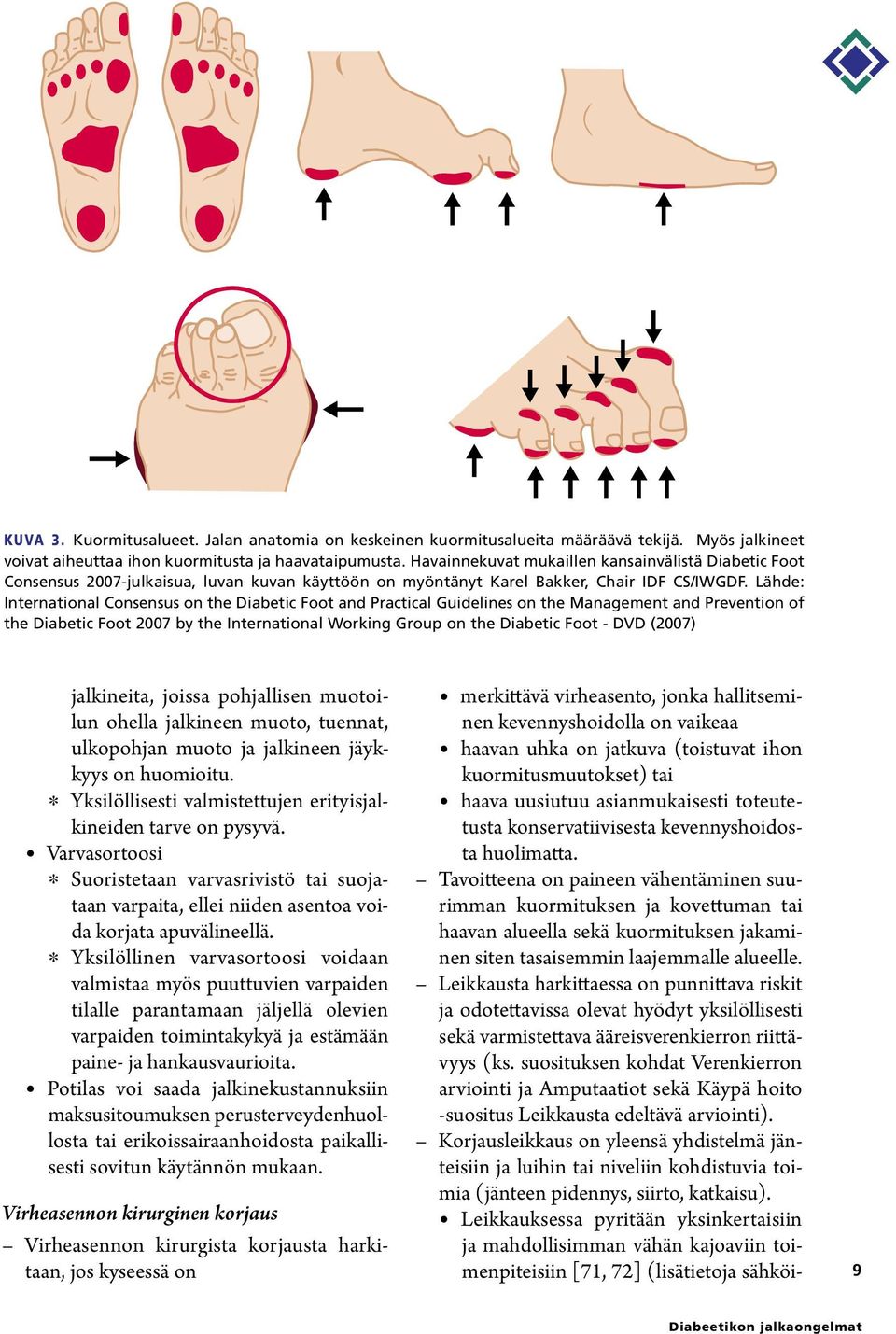 Lähde: International Consensus on the Diabetic Foot and Practical Guidelines on the Management and Prevention of the Diabetic Foot 2007 by the International Working Group on the Diabetic Foot - DVD