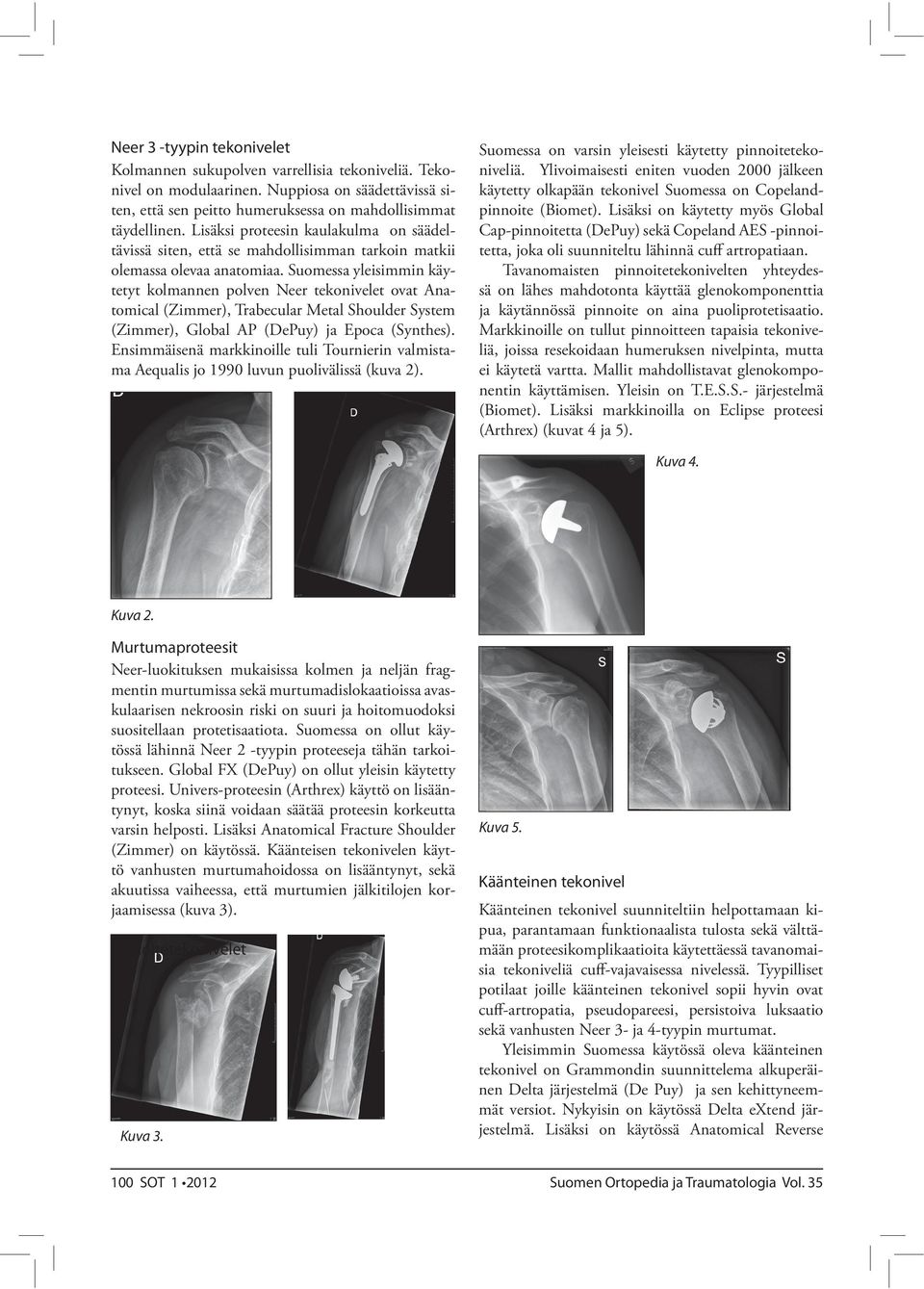 Suomessa yleisimmin käytetyt kolmannen polven Neer tekonivelet ovat Anatomical (Zimmer), Trabecular Metal Shoulder System (Zimmer), Global AP (DePuy) ja Epoca (Synthes).