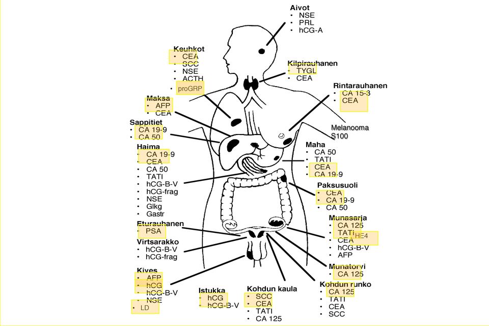 SCC! CEA! TATI! CA 125 Kilpirauhanen! TYGL! CEA Rintarauhanen! CA 15-3! CEA Melanooma! S100! Maha! CA 50! TATI! CEA! CA 19-9 Paksusuoli!