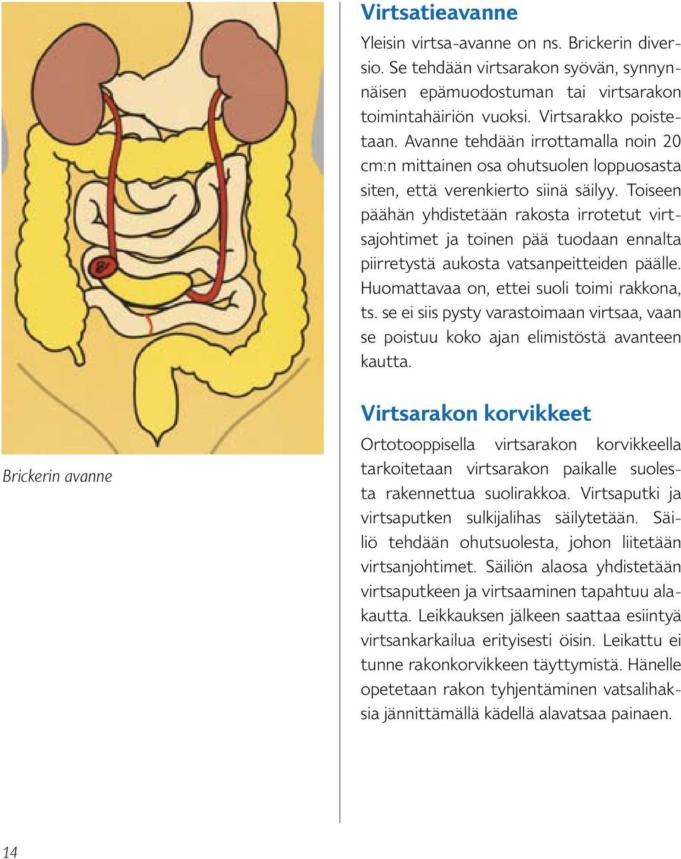 Toiseen päähän yhdistetään rakosta irrotetut virtsajohtimet ja toinen pää tuodaan ennalta piirretystä aukosta vatsanpeitteiden päälle. Huomattavaa on, ettei suoli toimi rakkona, ts.