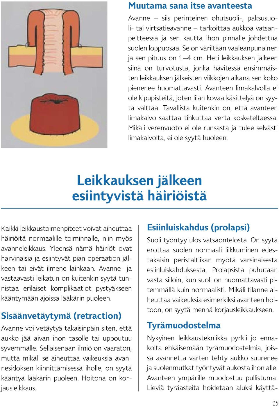 Heti leikkauksen jälkeen siinä on turvotusta, jonka hävitessä ensimmäisten leikkauksen jälkeisten viikkojen aikana sen koko pienenee huomattavasti.