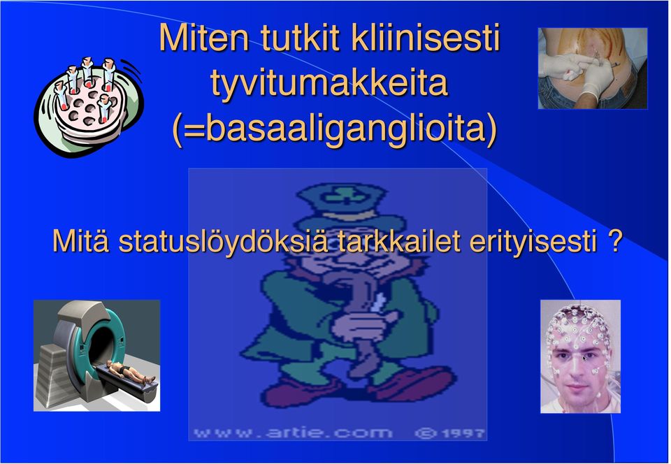 (=basaaliganglioita) Mitä