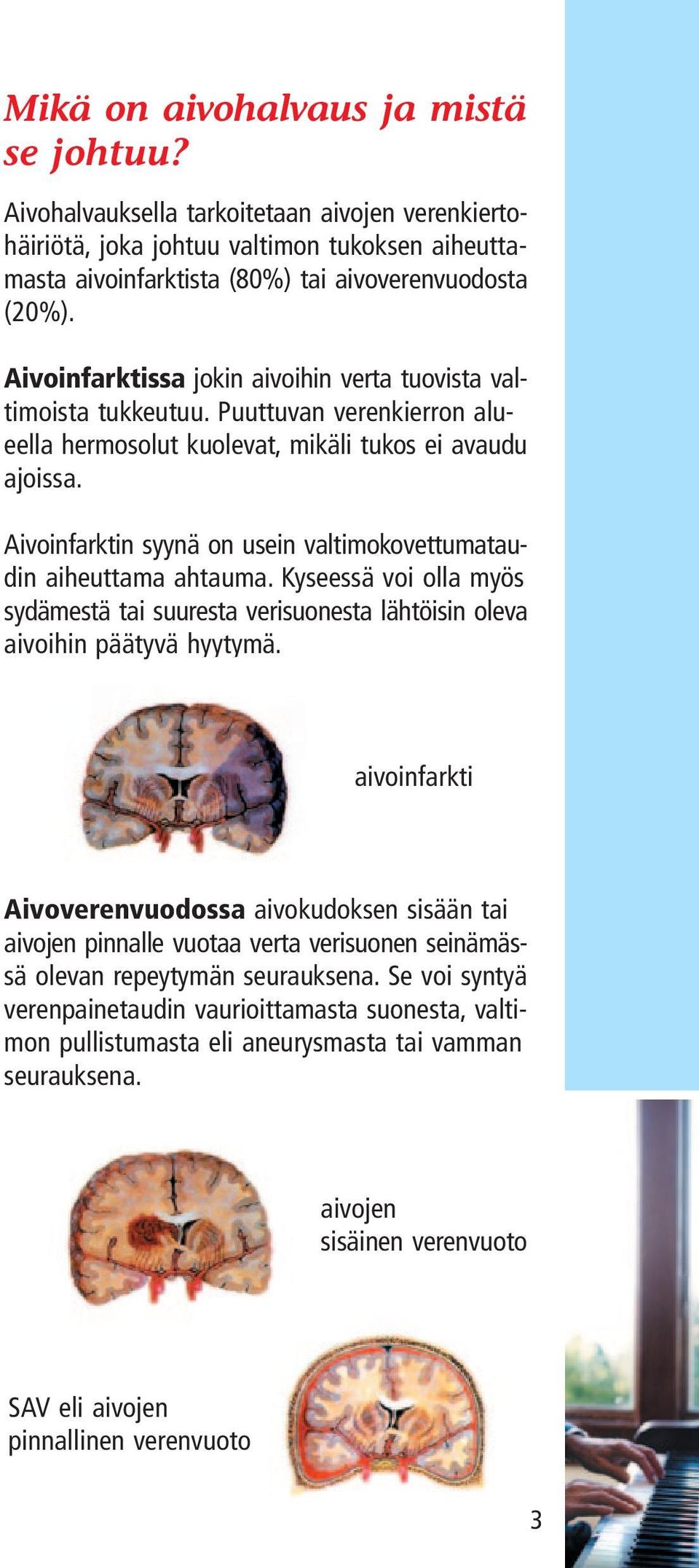 Aivoinfarktin syynä on usein valtimokovettumataudin aiheuttama ahtauma. Kyseessä voi olla myös sydämestä tai suuresta verisuonesta lähtöisin oleva aivoihin päätyvä hyytymä.