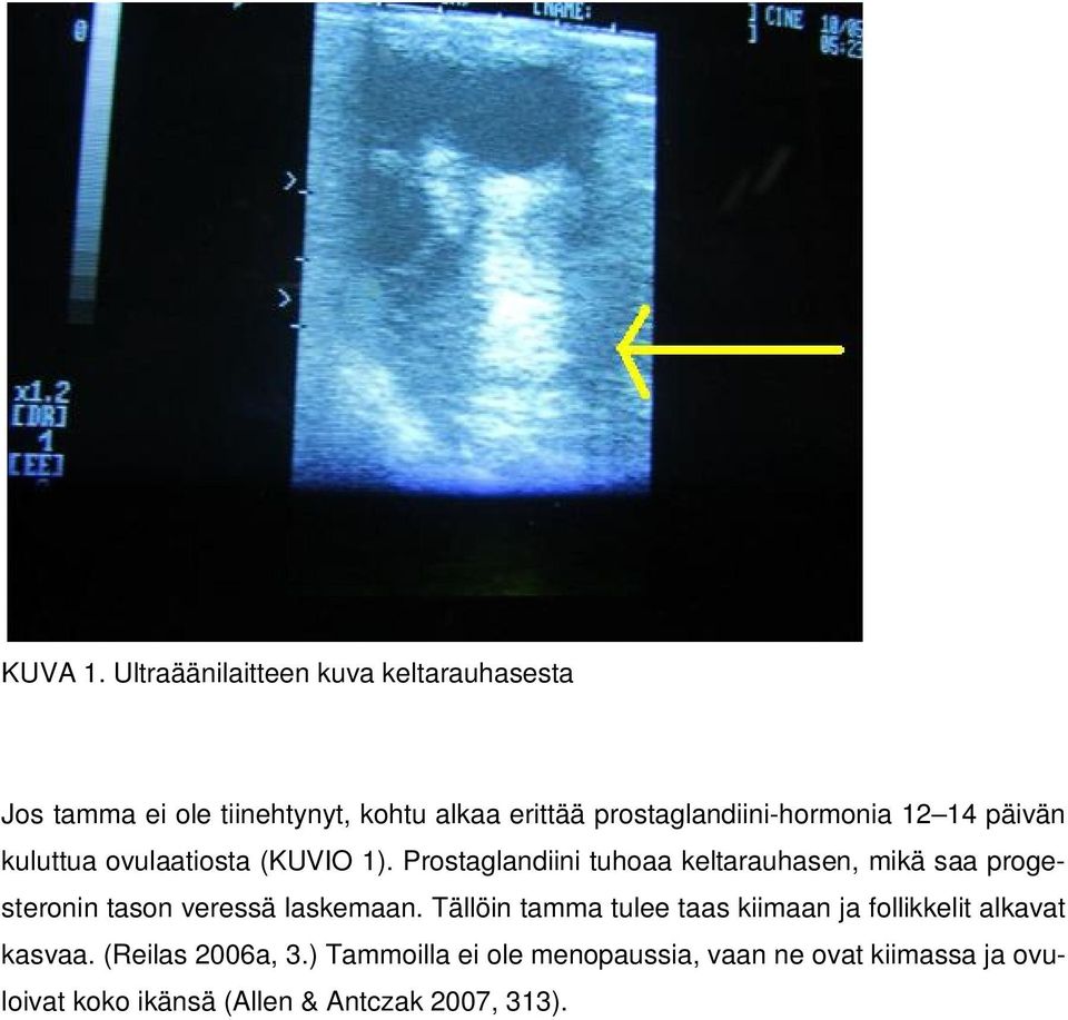 prostaglandiini-hormonia 12 14 päivän kuluttua ovulaatiosta (KUVIO 1).
