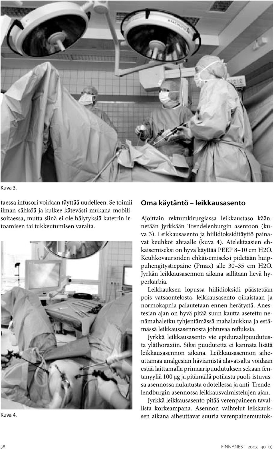 Leikkausasento ja hiilidioksiditäyttö painavat keuhkot ahtaalle (kuva 4). Atelektaasien ehkäisemiseksi on hyvä käyttää PEEP 8 10 cm H2O.