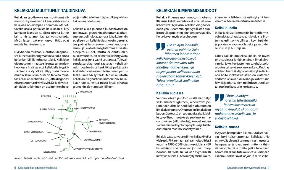 Nykytiedon mukaan suoliston ulkopuoliset oireet tai ilmentymät voivat olla ainoa keliakian jäljille johtava tekijä.