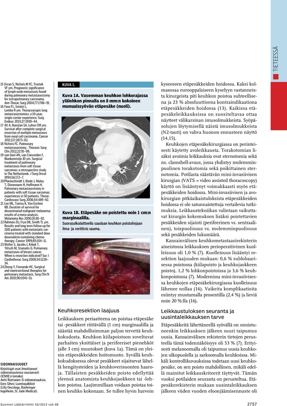 17 Alt A, Boorjian SA, Lohse CM ym. Survival after complete surgical resection of multiple metastases from renal cell carcinoma. Cancer 2011;117:2873 82. 18 Nichols FC. Pulmonary metastasectomy.