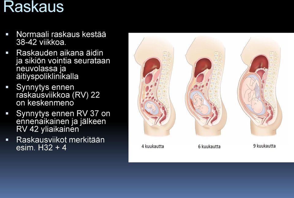 äitiyspoliklinikalla Synnytys ennen raskausviikkoa (RV) 22 on keskenmeno