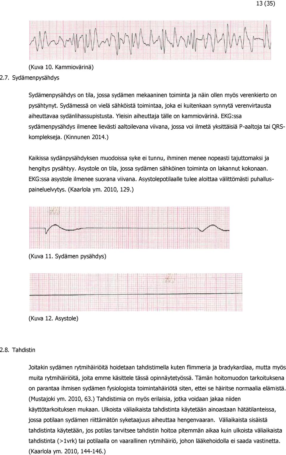 EKG:ssa sydämenpysähdys ilmenee lievästi aaltoilevana viivana, jossa voi ilmetä yksittäisiä P-aaltoja tai QRSkomplekseja. (Kinnunen 2014.
