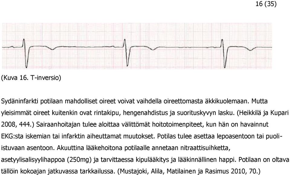 ) Sairaanhoitajan tulee aloittaa välittömät hoitotoimenpiteet, kun hän on havainnut EKG:sta iskemian tai infarktin aiheuttamat muutokset.