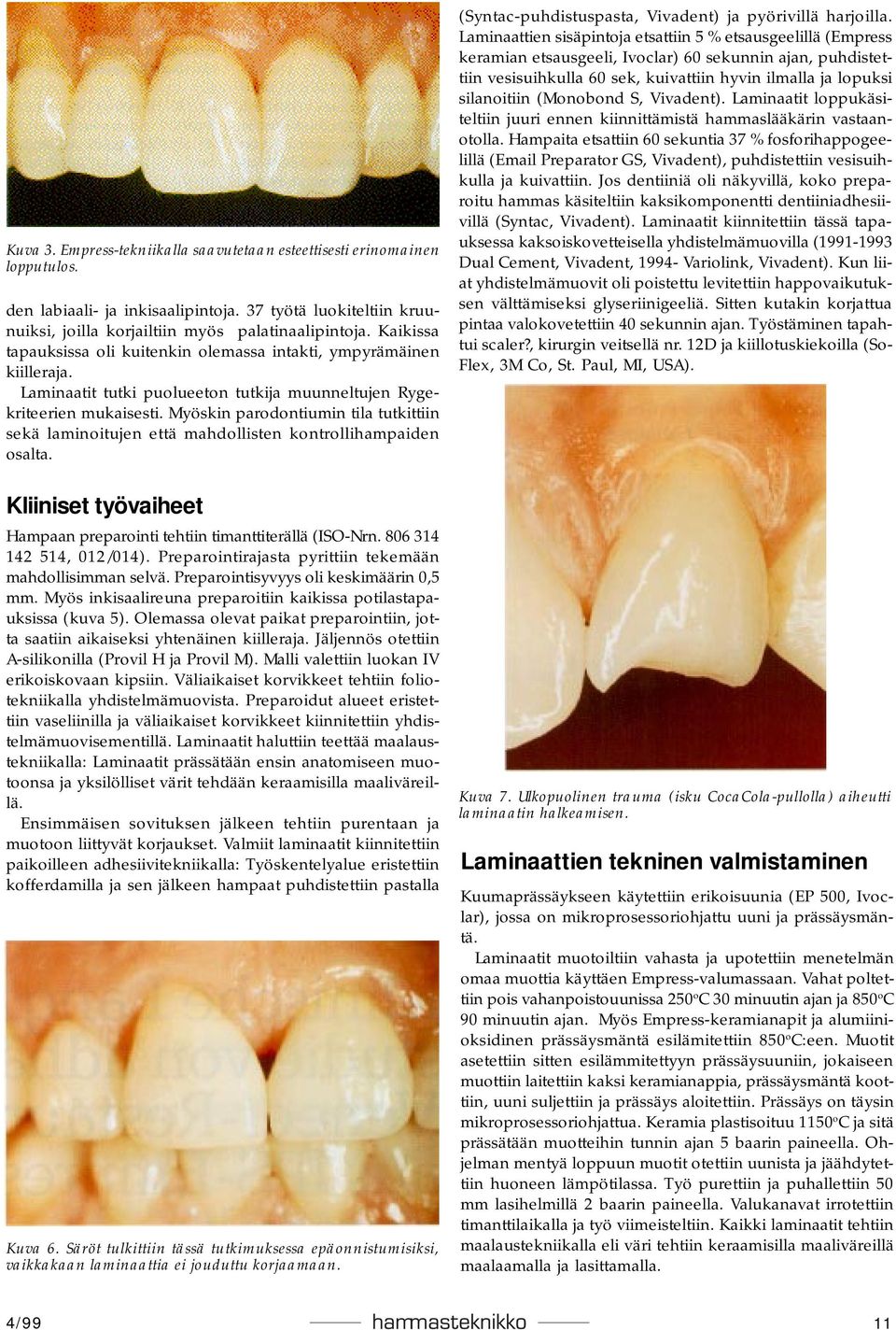 Myöskin parodontiumin tila tutkittiin sekä laminoitujen että mahdollisten kontrollihampaiden osalta. Kliiniset työvaiheet Hampaan preparointi tehtiin timanttiterällä (ISO-Nrn.