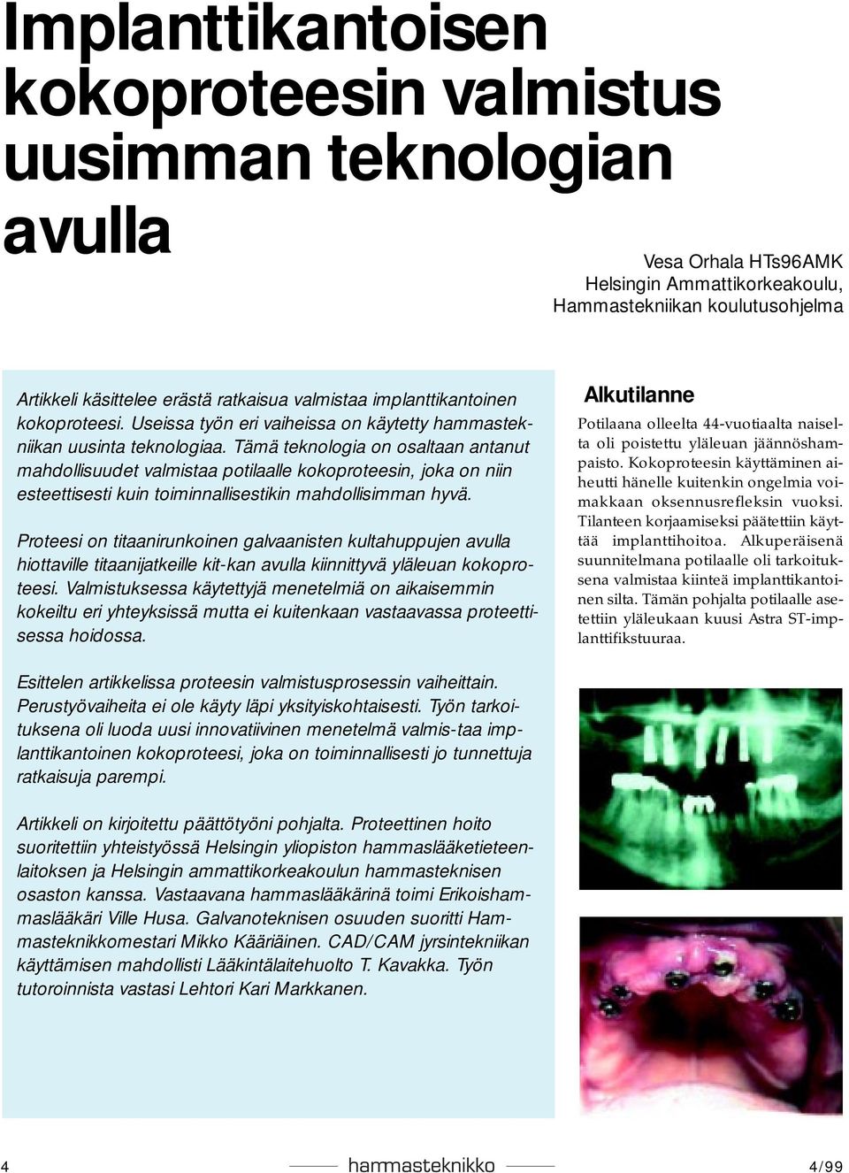 Tämä teknologia on osaltaan antanut mahdollisuudet valmistaa potilaalle kokoproteesin, joka on niin esteettisesti kuin toiminnallisestikin mahdollisimman hyvä.