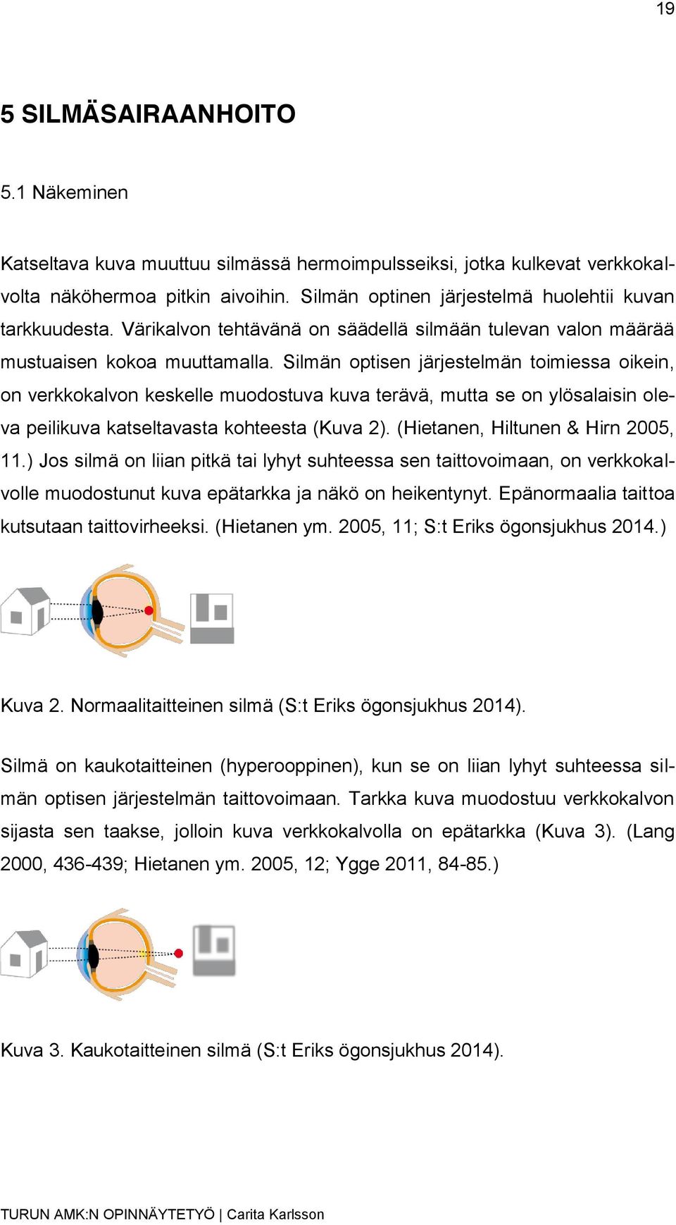 Silmän optisen järjestelmän toimiessa oikein, on verkkokalvon keskelle muodostuva kuva terävä, mutta se on ylösalaisin oleva peilikuva katseltavasta kohteesta (Kuva 2).