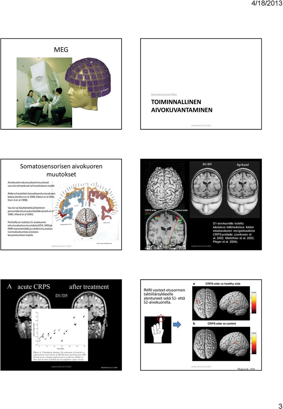 muutoksia (EEG, MEG ja fmri menetelmillä) ja näiden muutosten normalisoitumista oireiston korjaantumisen myötä. Kuva: www.studyblue.