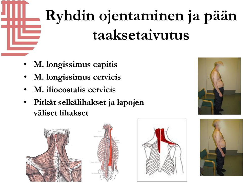 longissimus cervicis M.