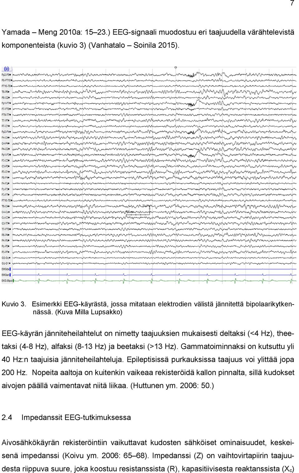 (Kuva Milla Lupsakko) EEG-käyrän jänniteheilahtelut on nimetty taajuuksien mukaisesti deltaksi (<4 Hz), theetaksi (4-8 Hz), alfaksi (8-13 Hz) ja beetaksi (>13 Hz).