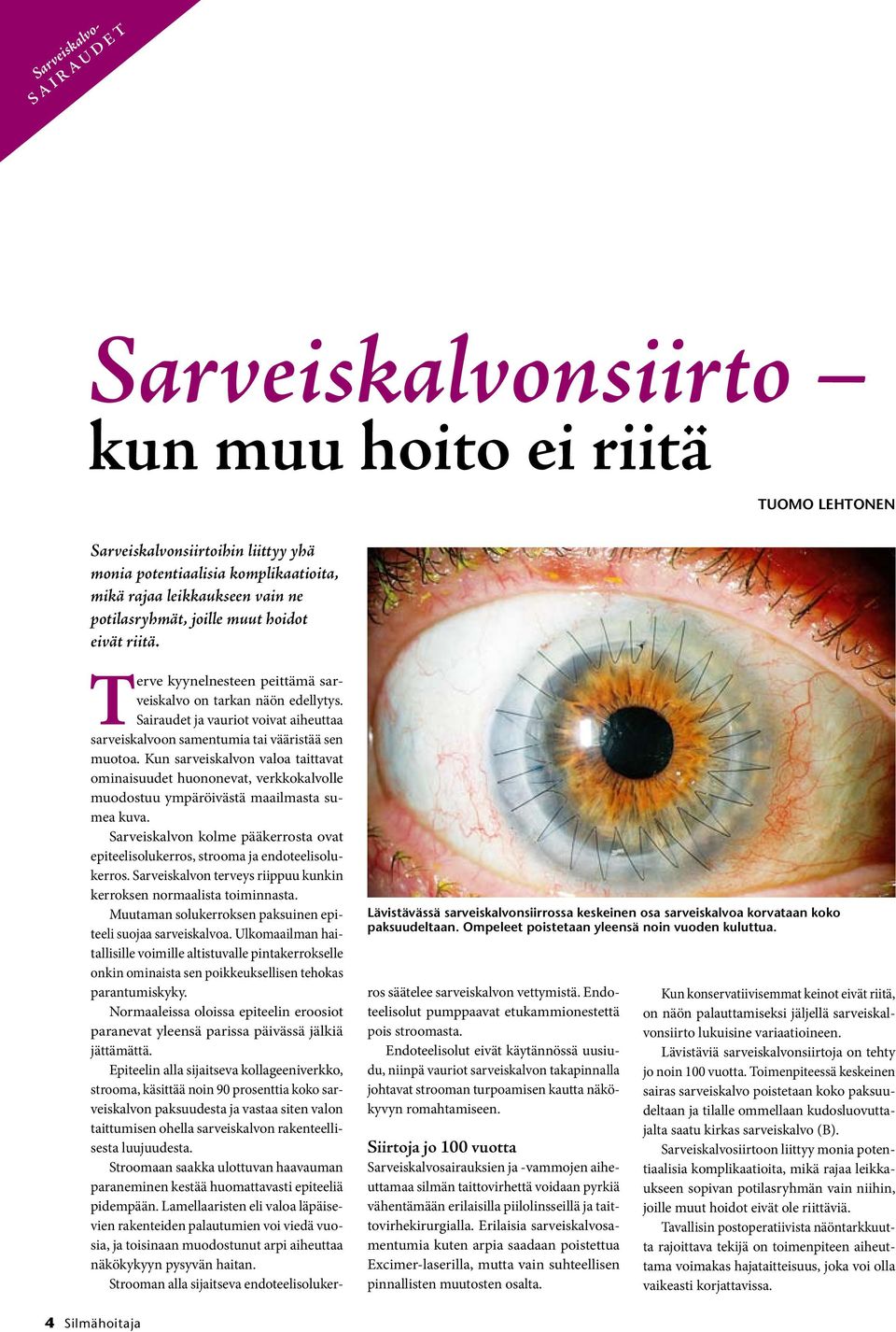 Sairaudet ja vauriot voivat aiheuttaa sarveiskalvoon samentumia tai vääristää sen muotoa.
