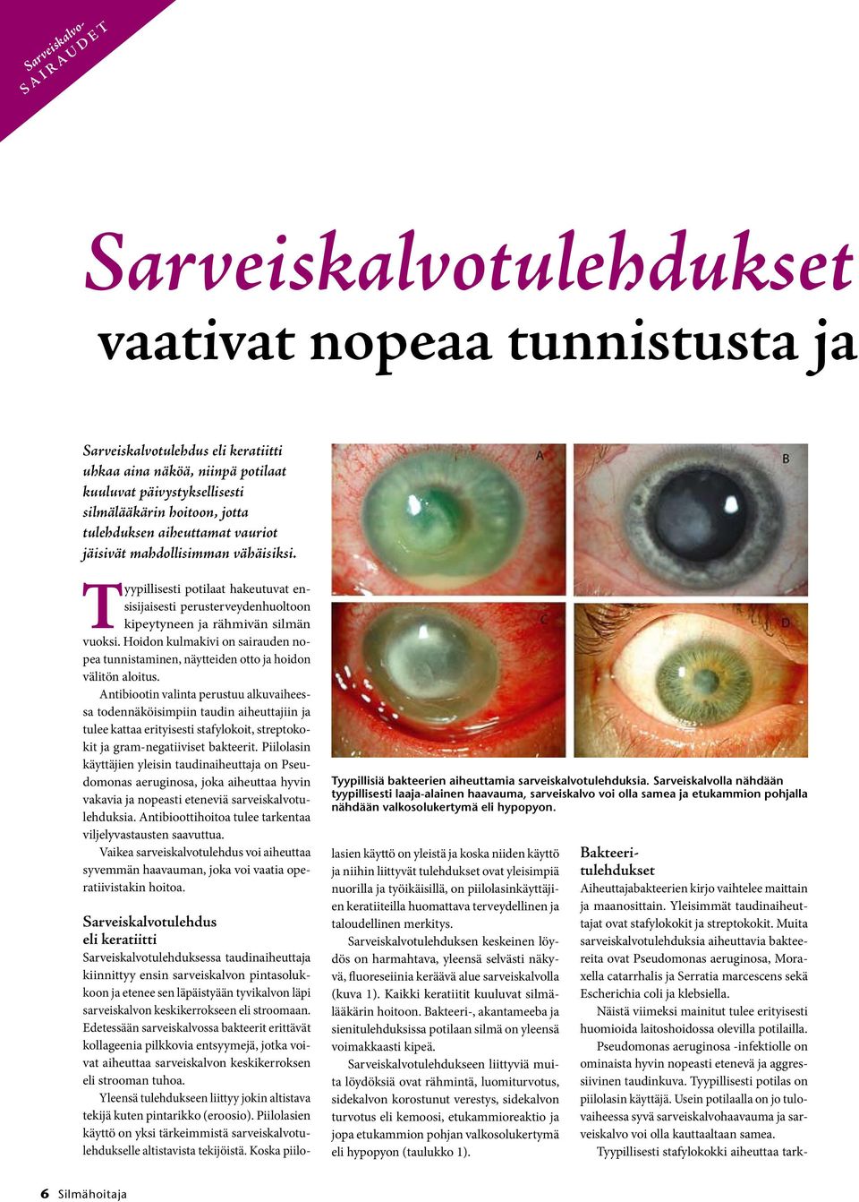 Hoidon kulmakivi on sairauden nopea tunnistaminen, näytteiden otto ja hoidon välitön aloitus.