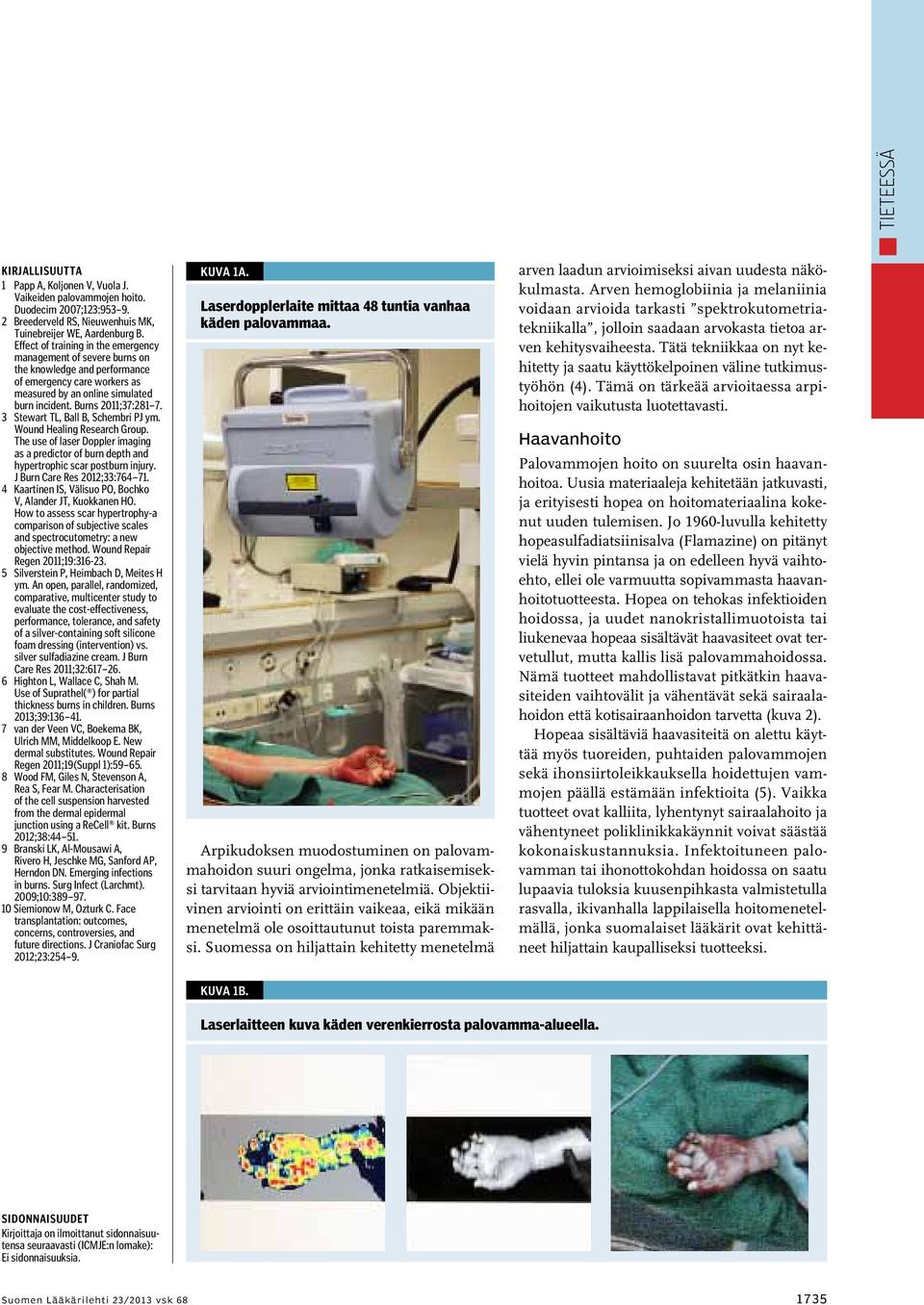 3 Stewart TL, Ball B, Schembri PJ ym. Wound Healing Research Group. The use of laser Doppler imaging as a predictor of burn depth and hypertrophic scar postburn injury. J Burn Care Res 2012;33:764 71.