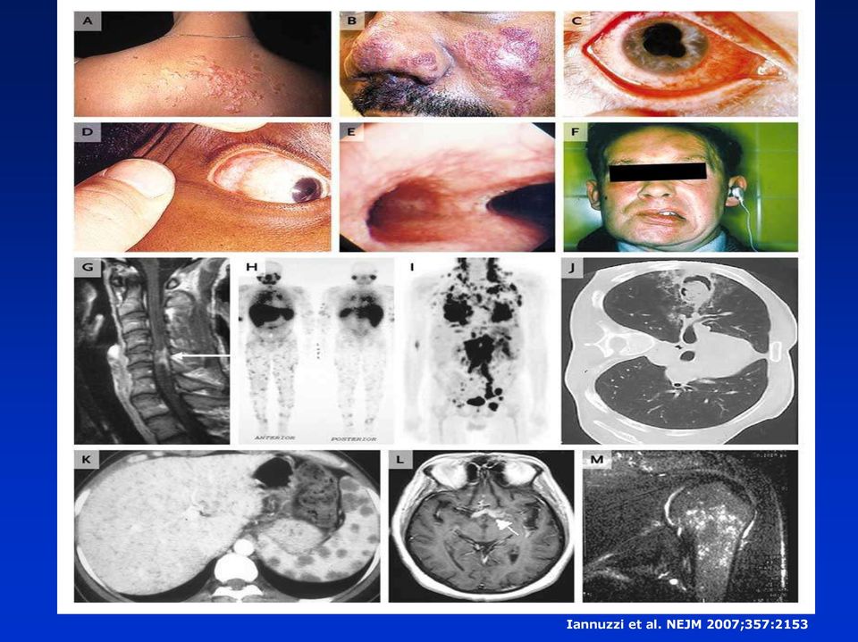 NEJM