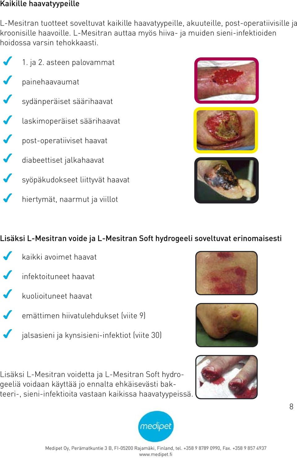 asteen palovammat painehaavaumat sydänperäiset säärihaavat laskimoperäiset säärihaavat post-operatiiviset haavat diabeettiset jalkahaavat syöpäkudokseet liittyvät haavat hiertymät, naarmut ja viillot