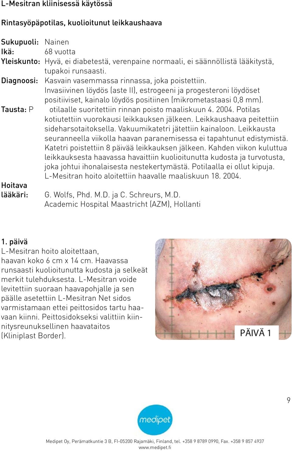 Invasiivinen löydös (aste II), estrogeeni ja progesteroni löydöset positiiviset, kainalo löydös positiinen (mikrometastaasi 0,8 mm). Tausta: P otilaalle suoritettiin rinnan poisto maaliskuun 4. 2004.