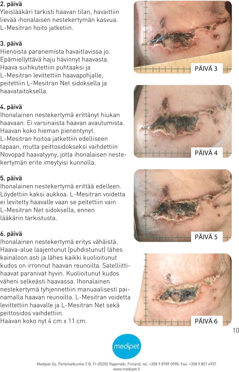 päivä Ihonalainen nestekertymä erittänyt hiukan haavaan. Ei varsinaista haavan avautumista. Haavan koko hieman pienentynyt.