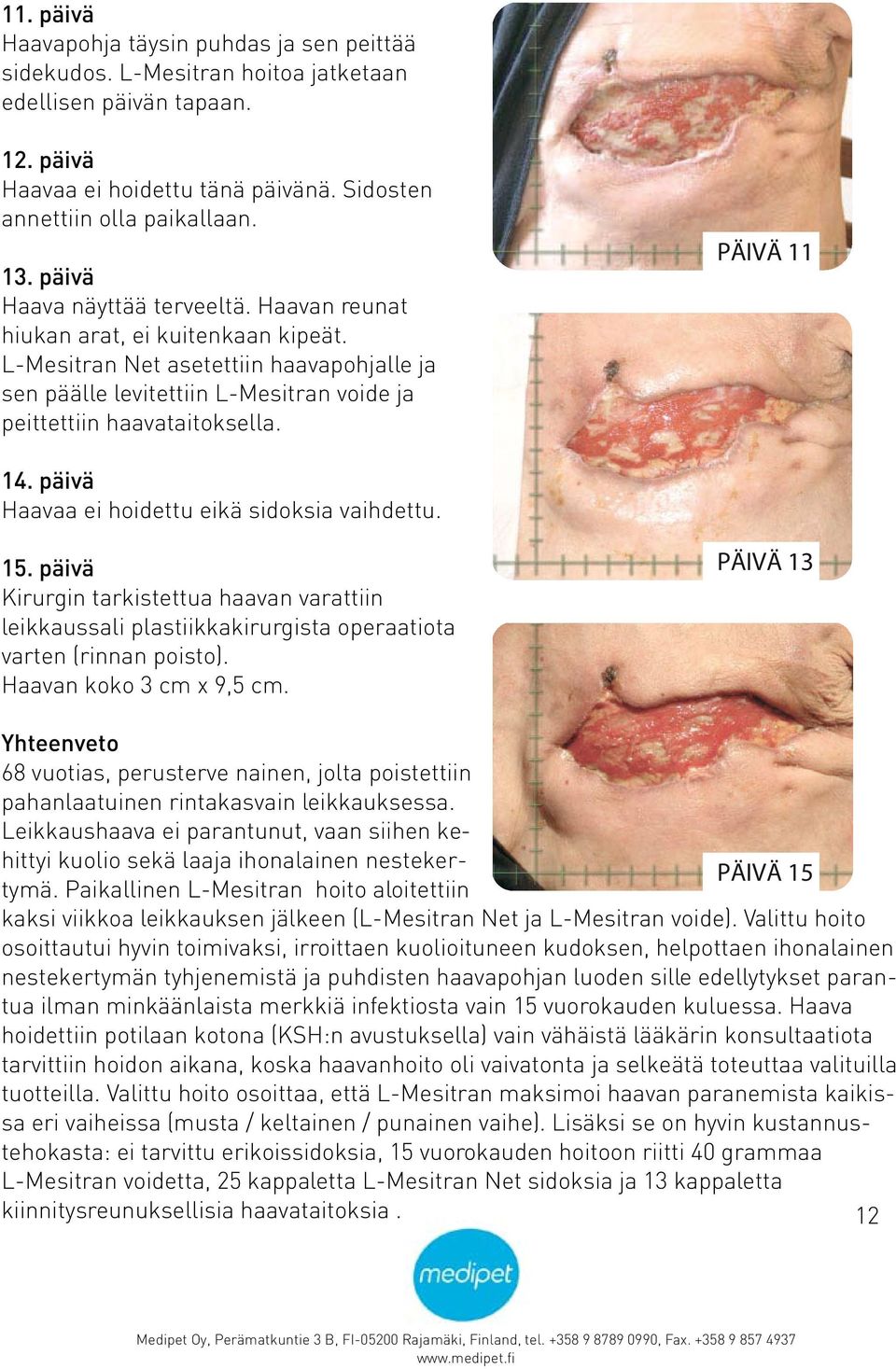 PÄIVÄ 11 14. päivä Haavaa ei hoidettu eikä sidoksia vaihdettu. 15. päivä Kirurgin tarkistettua haavan varattiin leikkaussali plastiikkakirurgista operaatiota varten (rinnan poisto).