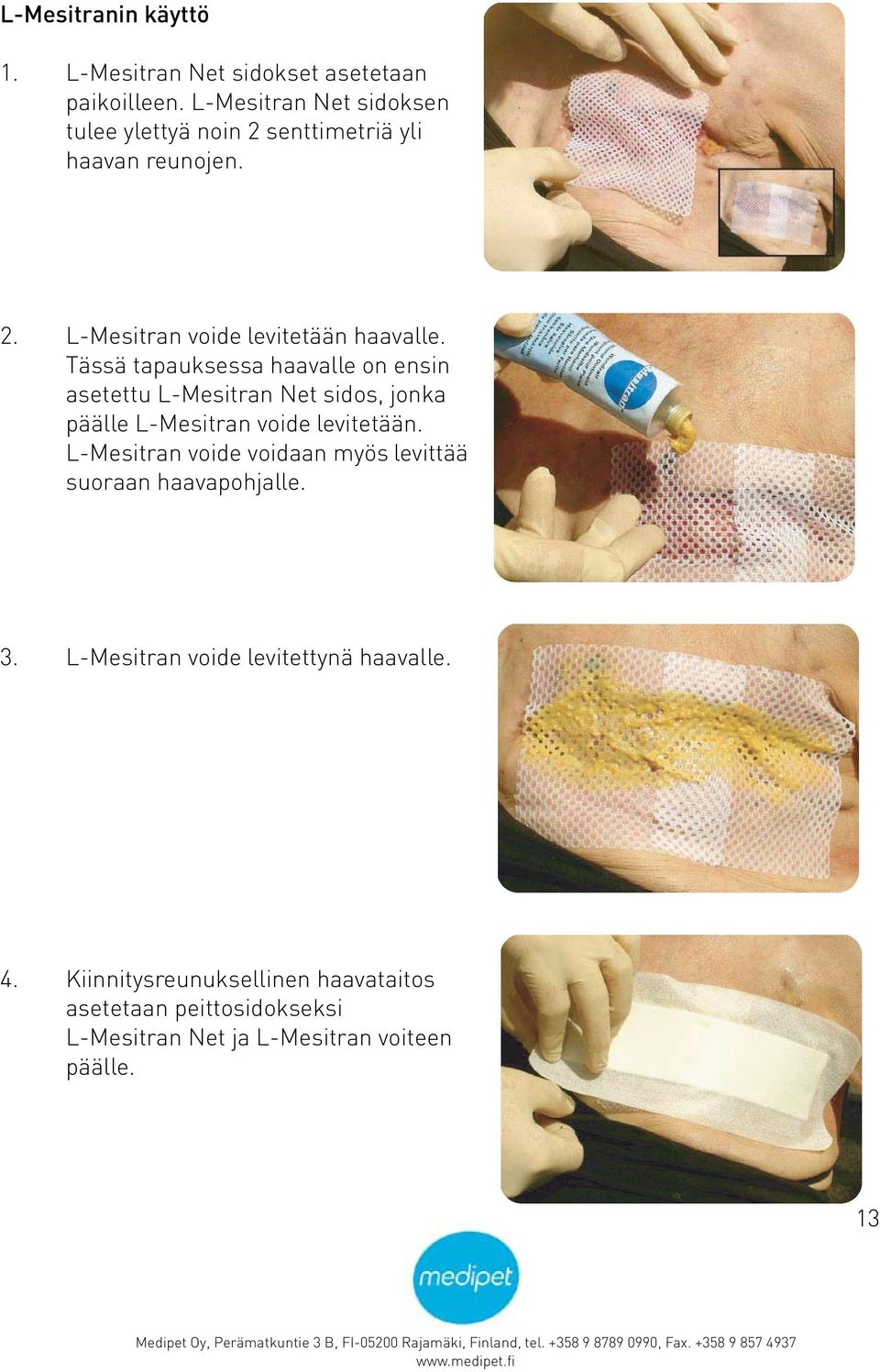 Tässä tapauksessa haavalle on ensin asetettu L-Mesitran Net sidos, jonka päälle L-Mesitran voide levitetään.