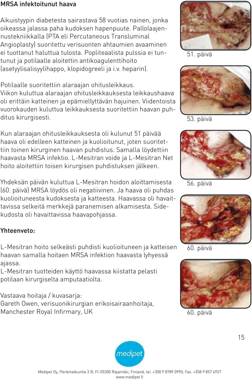 Popliteaalista pulssia ei tuntunut ja potilaalle aloitettin antikoagulenttihoito (asetyylisalisyylihappo, klopidogreeli ja i.v. heparin). Potilaalle suoritettiin alaraajan ohitusleikkaus.