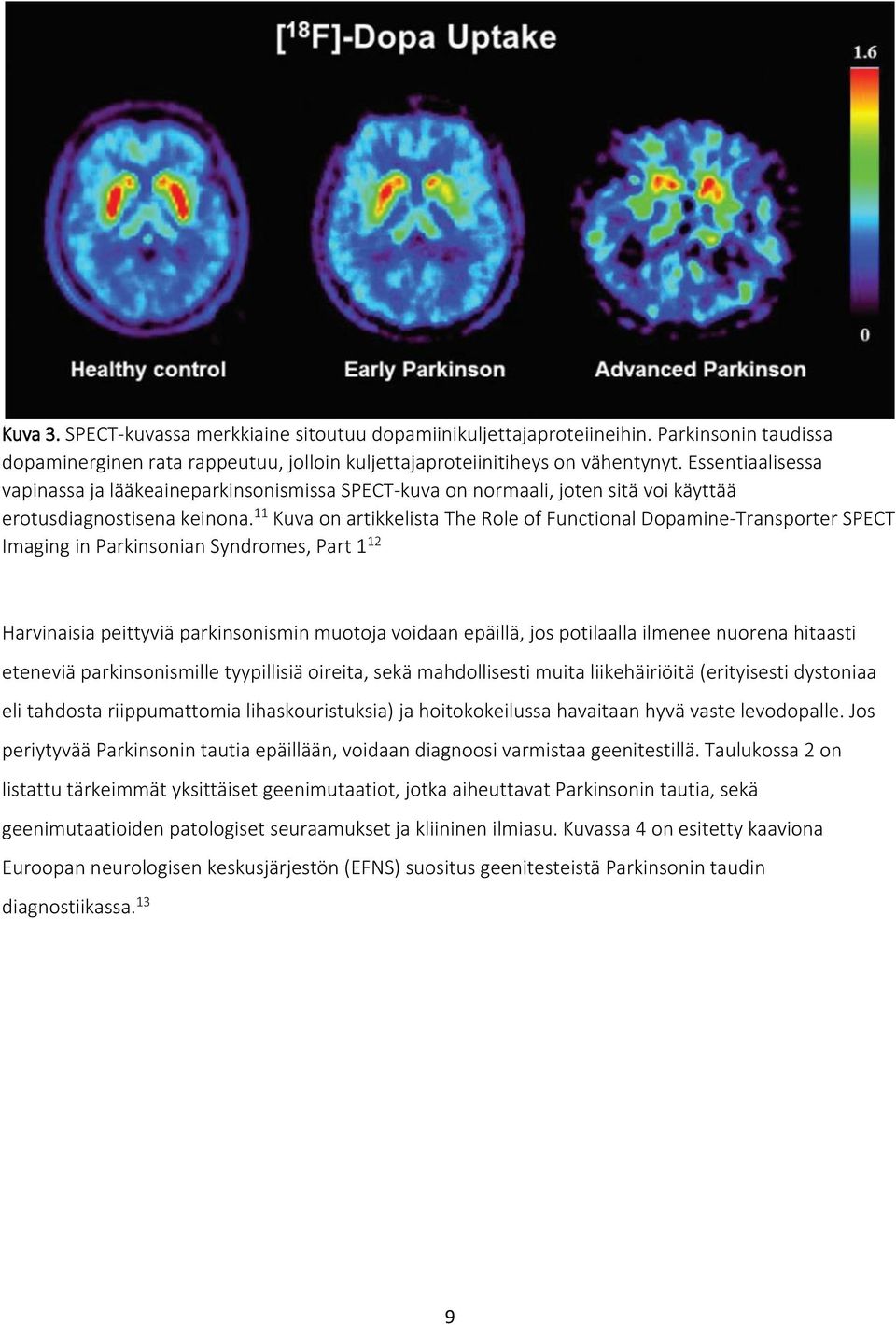11 Kuva on artikkelista The Role of Functional Dopamine-Transporter SPECT Imaging in Parkinsonian Syndromes, Part 1 12 Harvinaisia peittyviä parkinsonismin muotoja voidaan epäillä, jos potilaalla