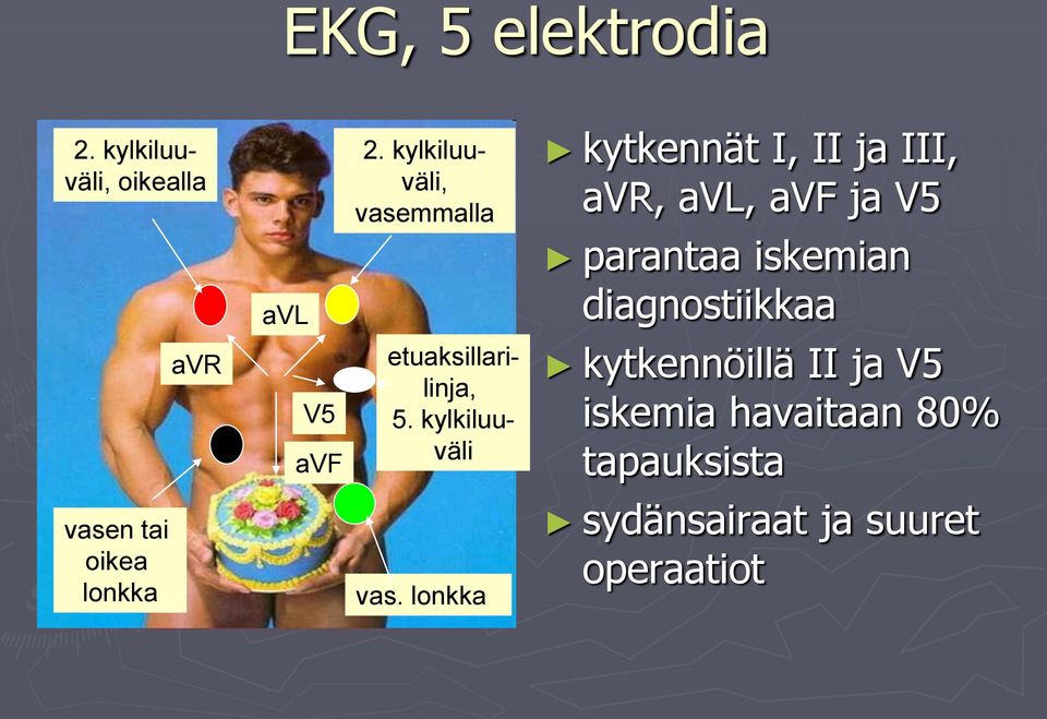 iskemian diagnostiikkaa avr V5 avf etuaksillarilinja, 5.