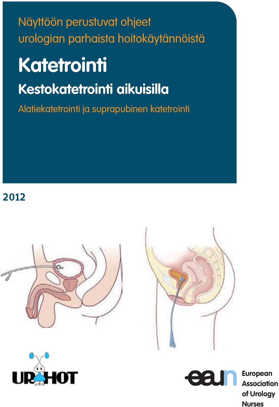 aikuisilla Alatiekatetrointi ja suprapubinen