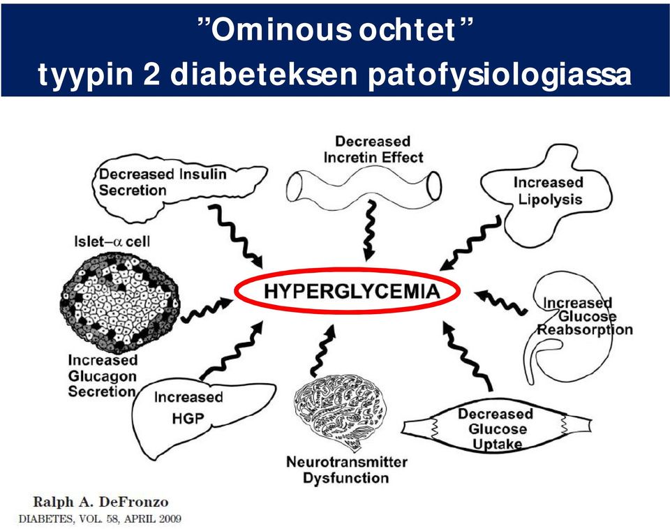 2 diabeteksen