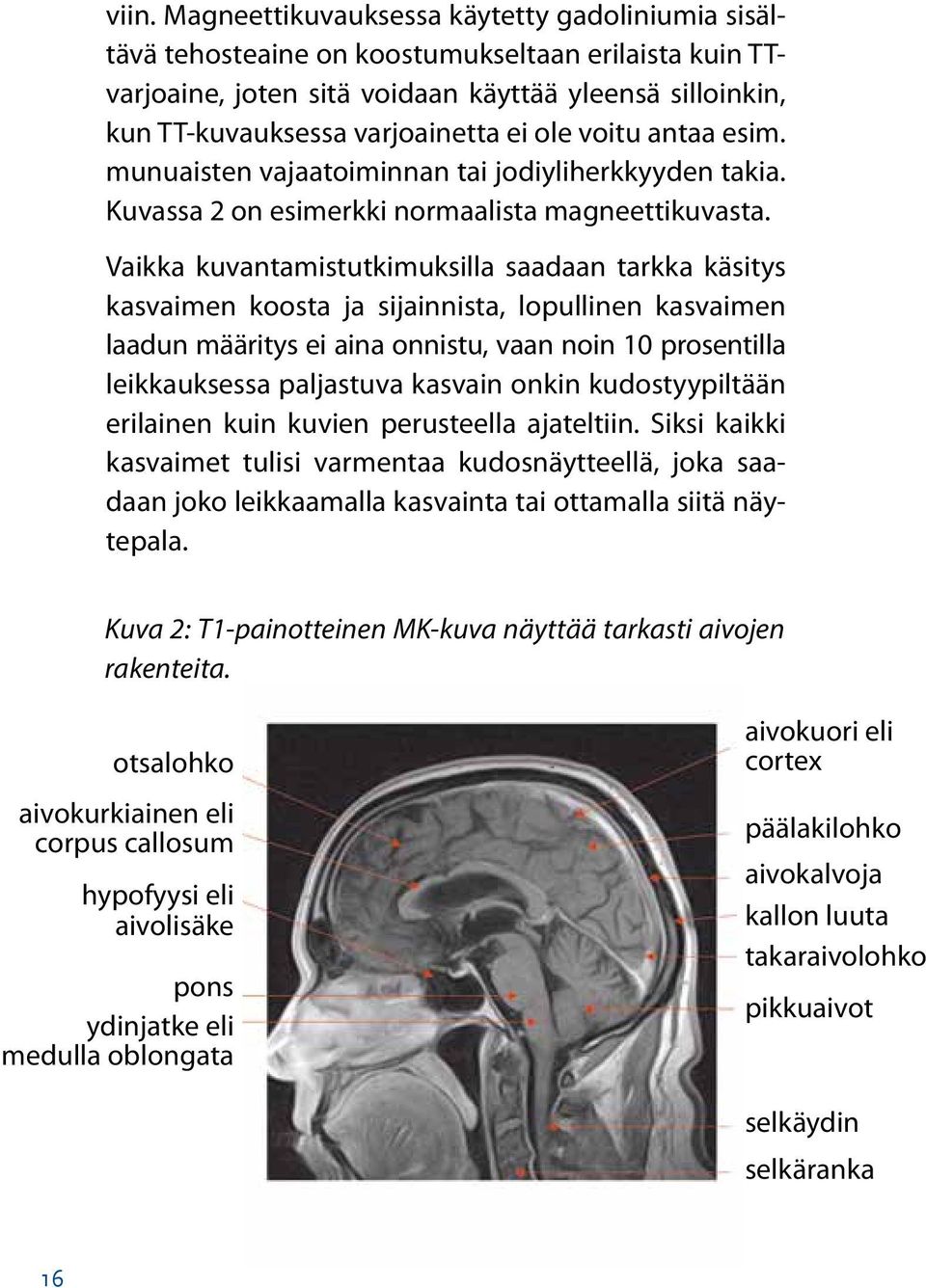 Vaikka kuvantamistutkimuksilla saadaan tarkka käsitys kasvaimen koosta ja sijainnista, lopullinen kasvaimen laadun määritys ei aina onnistu, vaan noin 10 prosentilla leikkauksessa paljastuva kasvain