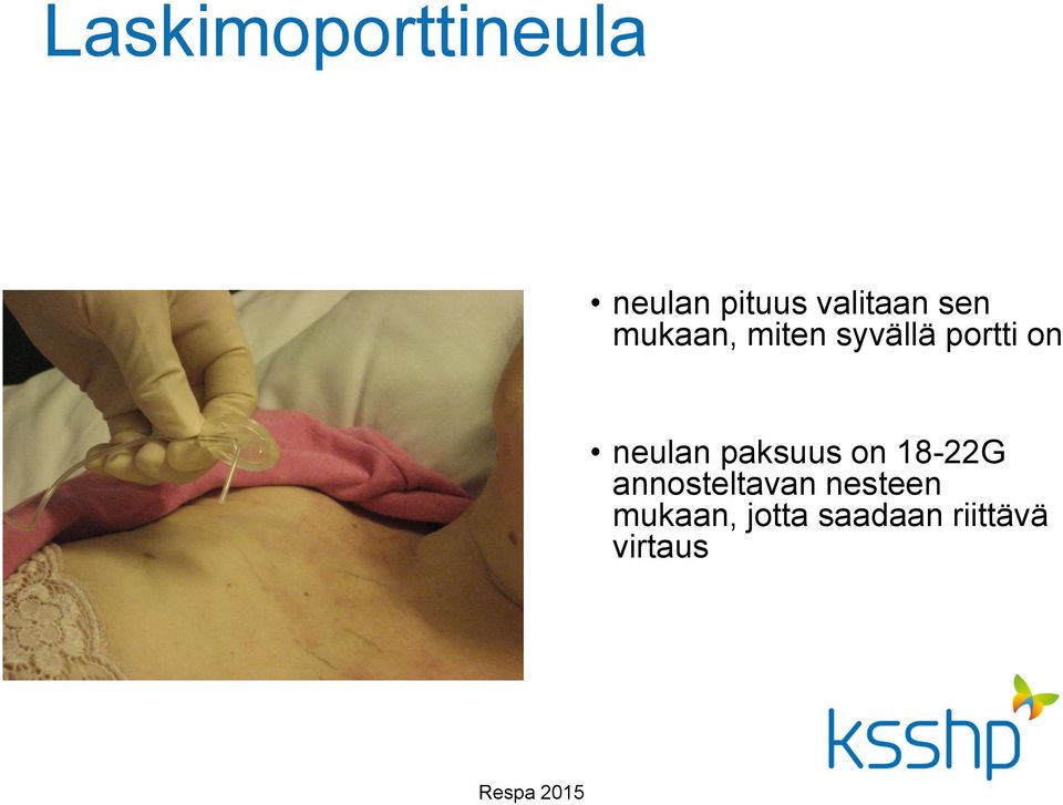 portti on neulan paksuus on 18-22G