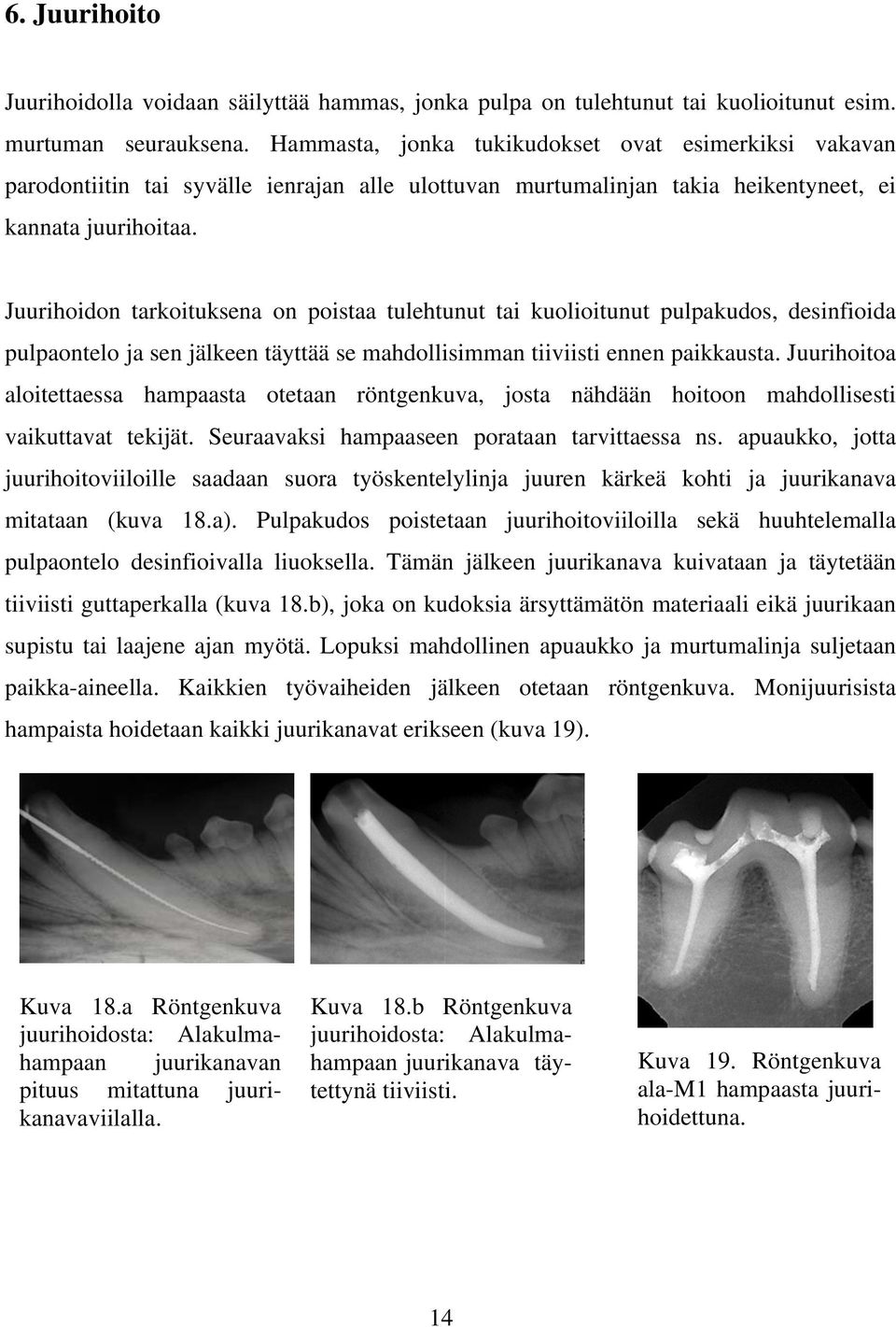 Juurihoidon tarkoituksena on poistaa tulehtunut tai kuolioitunut pulpakudos, desinfioida pulpaontelo ja sen jälkeen täyttää se mahdollisimman tiiviisti ennen paikkausta.