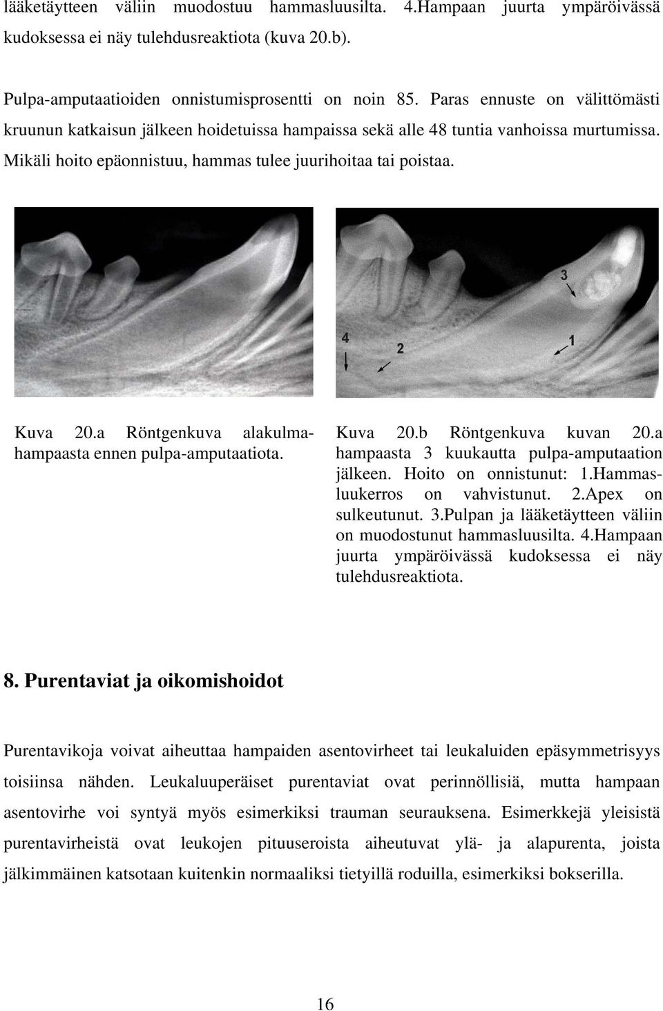 a Röntgenkuva alakulmahampaasta ennen pulpa-amputaatiota. Kuva 20.b Röntgenkuva kuvan 20.a hampaasta 3 kuukautta pulpa-amputaation jälkeen. Hoito on onnistunut: 1.Hammasluukerros on vahvistunut. 2.Apex on sulkeutunut.