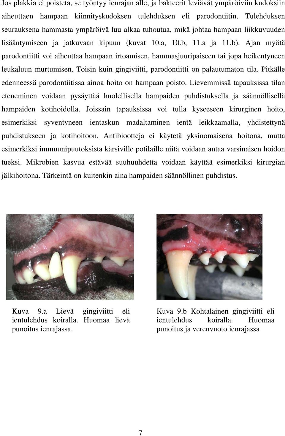 Ajan myötä parodontiitti voi aiheuttaa hampaan irtoamisen, hammasjuuripaiseen tai jopa heikentyneen leukaluun murtumisen. Toisin kuin gingiviitti, parodontiitti on palautumaton tila.