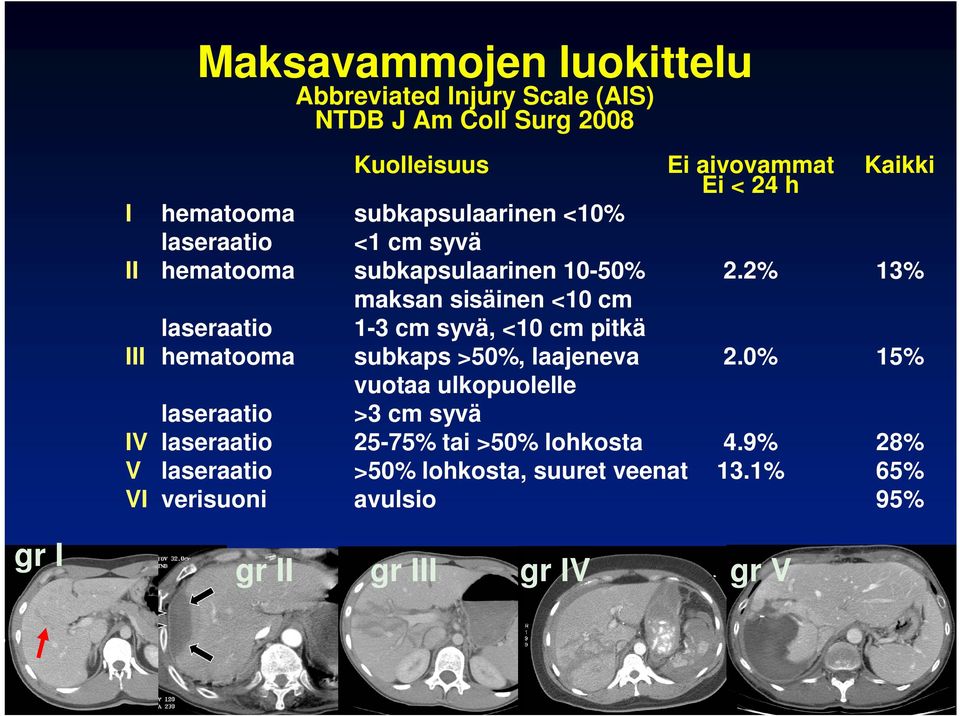 2% 13% maksan sisäinen <10 cm laseraatio 1-3 cm syvä, <10 cm pitkä III hematooma subkaps >50%, laajeneva 2.