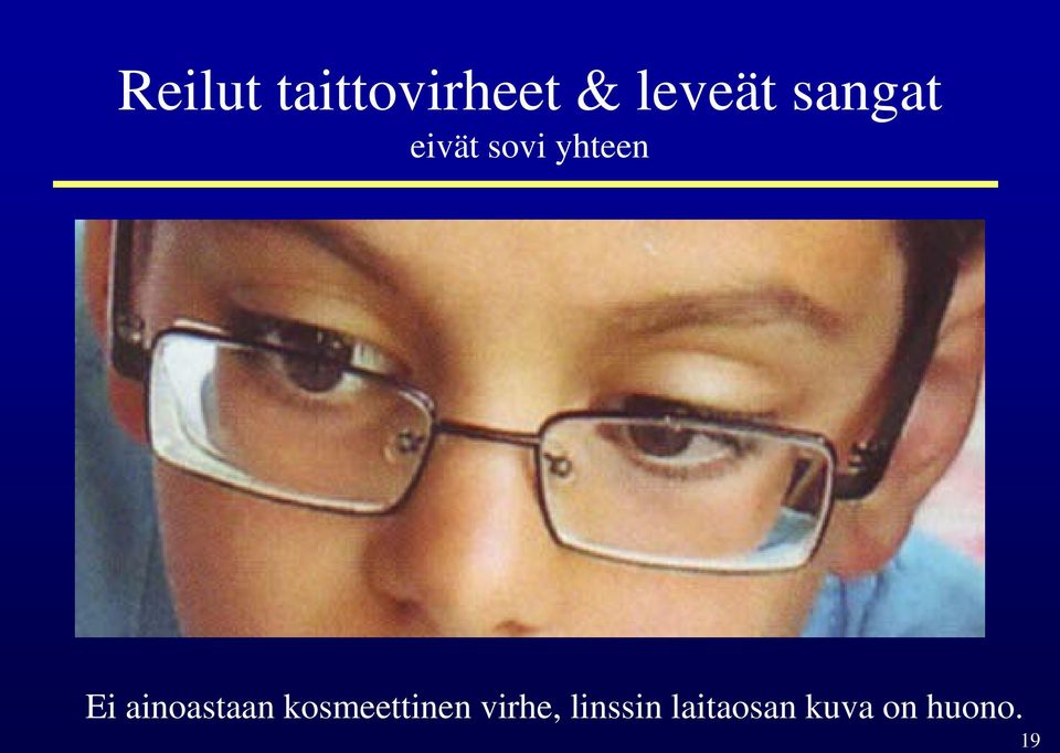 ainoastaan kosmeettinen virhe,