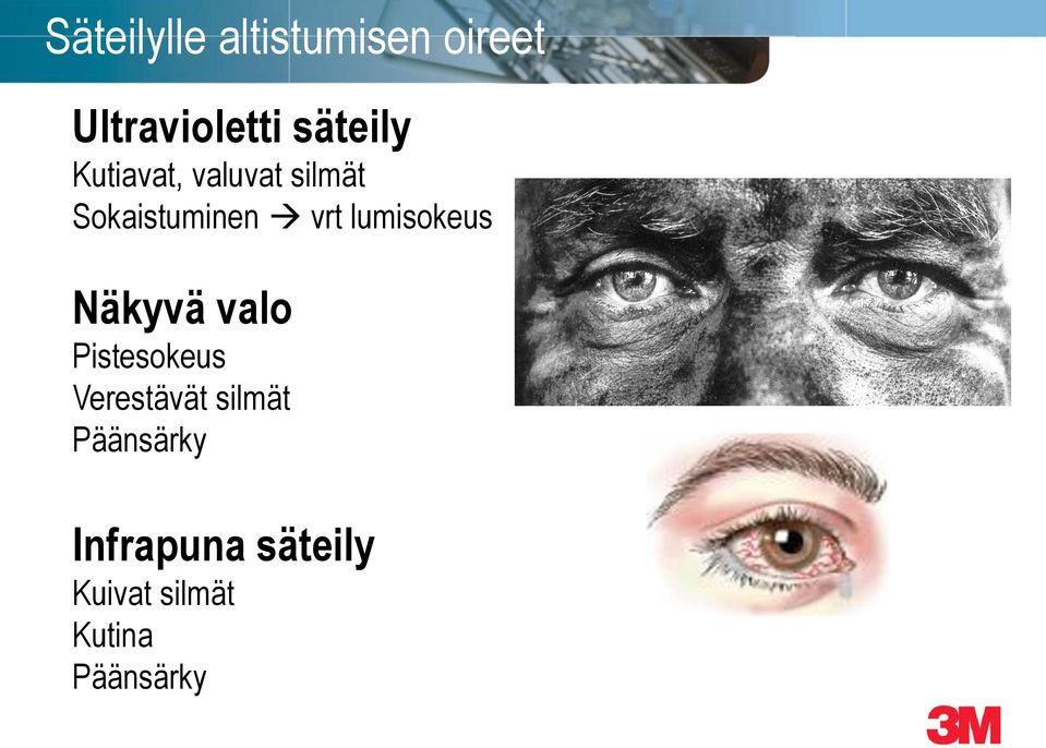 lumisokeus Näkyvä valo Pistesokeus Verestävät