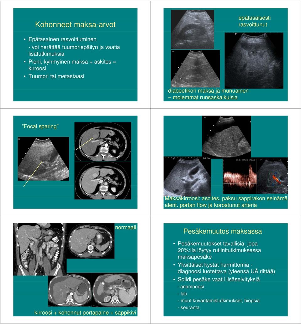 portan flow ja korostunut arteria normaali kirroosi + kohonnut portapaine + sappikivi Pesäkemuutos maksassa Pesäkemuutokset tavallisia, jopa 20%:lla löytyy rutiinitutkimuksessa