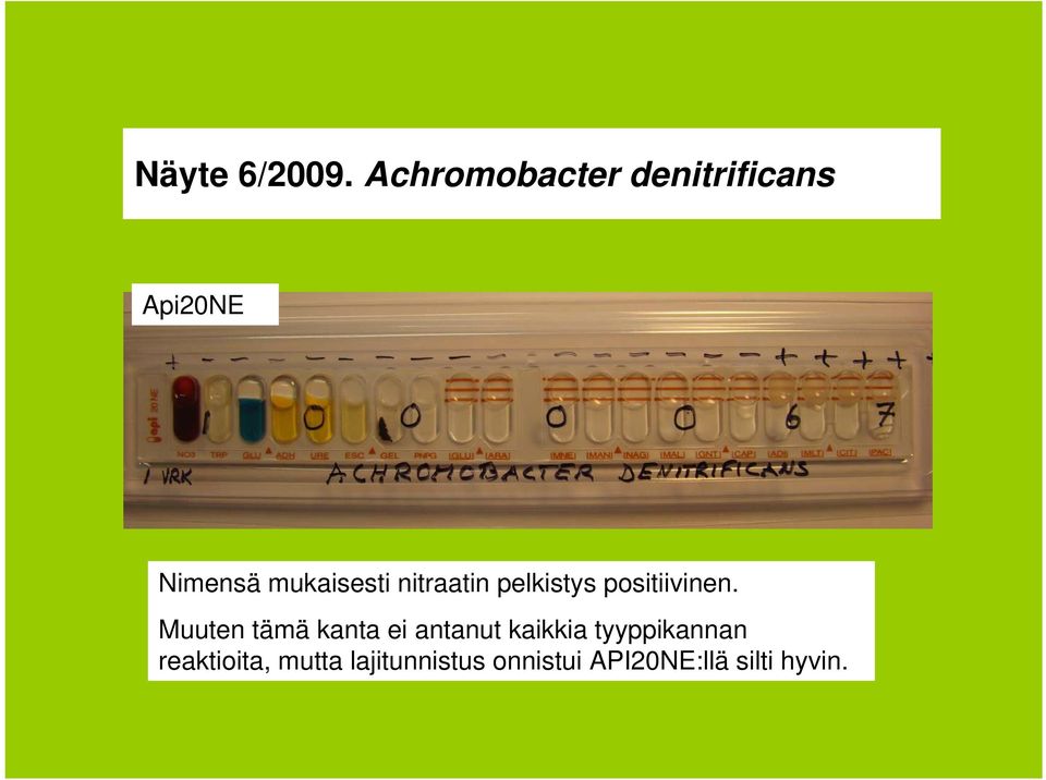 nitraatin pelkistys positiivinen.