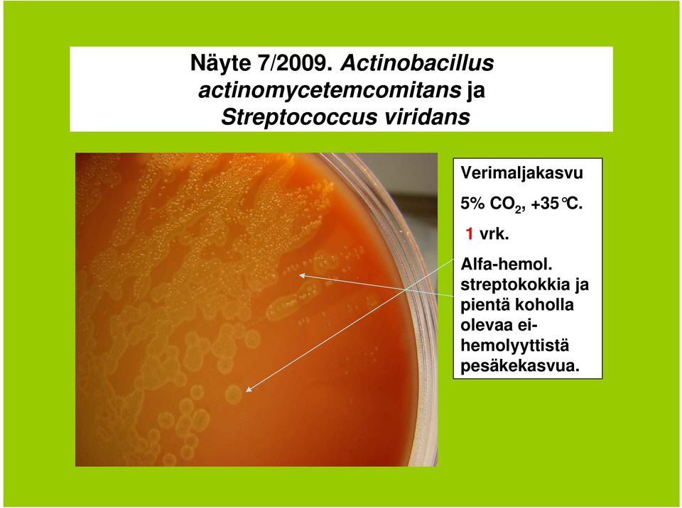 Streptococcus viridans Verimaljakasvu 5% CO 2,