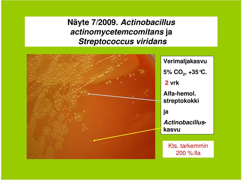 Streptococcus viridans Verimaljakasvu 5% CO 2,